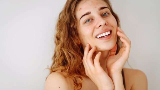 The Understanding The Difference Between Rosacea and Sensitive Skin

https://soleilra.com/rosacea-and-sensitive-skin-in-your-40s-difference-between-rosacea-and-sensitive-skin/