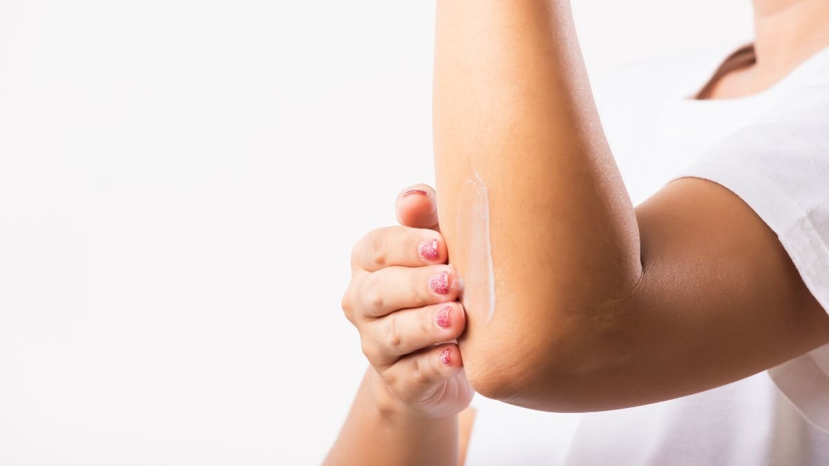 how-natural-body-butters-help-with-dry-arms-in-winter