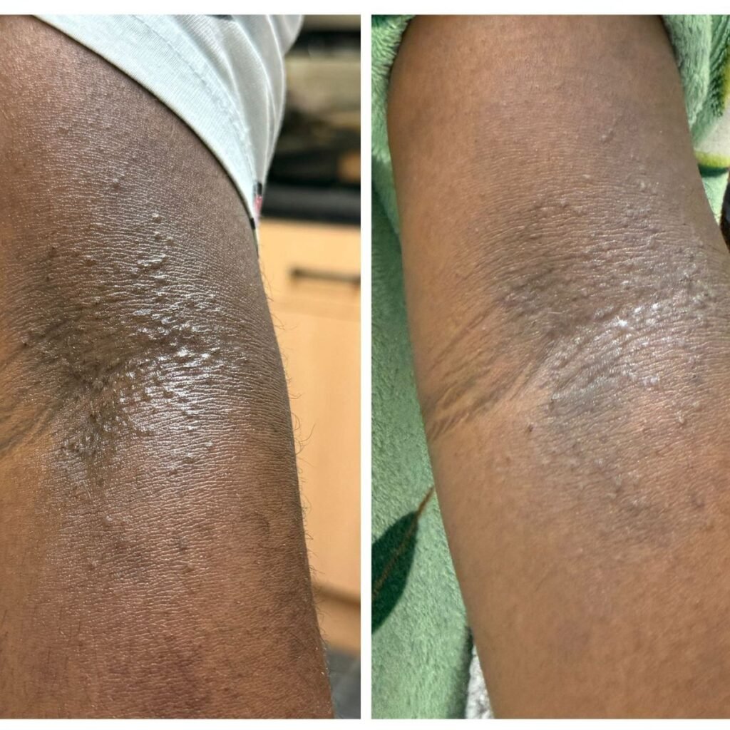 ultimate-guide-to-whipped-body-butter-your-solution-to-nourished-skin