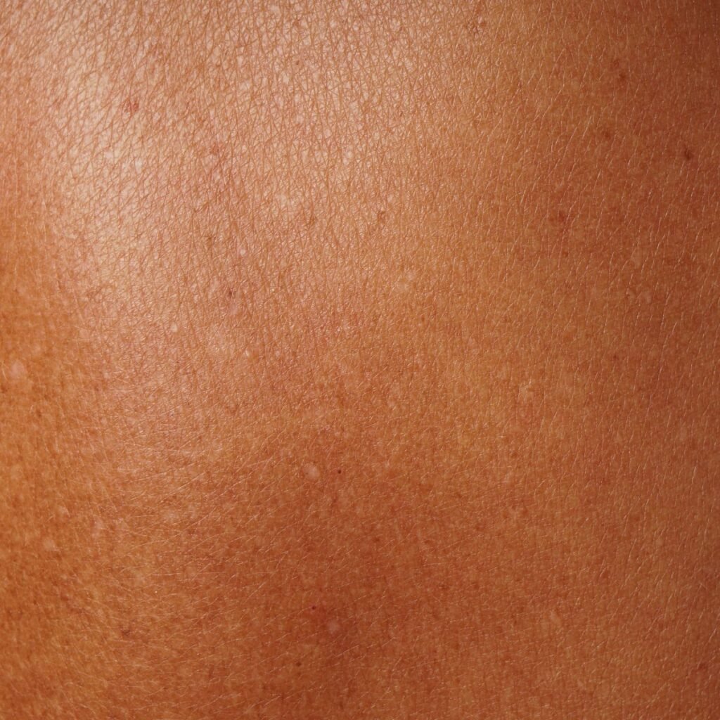 black-skin-with-brown-age-spots-on-skin